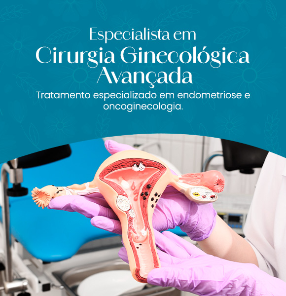 Especialista em Cirurgia Ginecológica Avançada-Slider Mobile